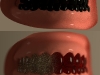 grainyteeth