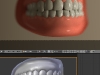 teethdof